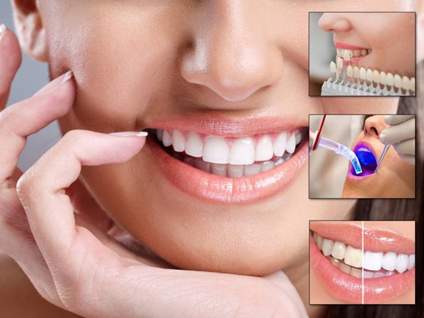 دندانپزشکی ترمیمی پر کردن دندان کامپوزیت دندان سرامیک دندان ونیر دندان لمینیت دندان