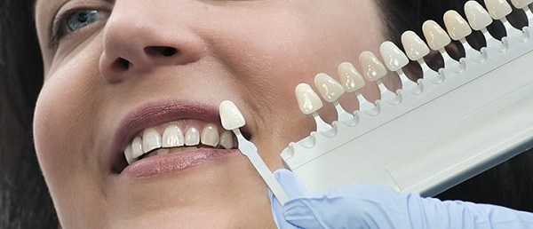 دندانپزشکی ترمیمی پر کردن دندان کامپوزیت دندان سرامیک دندان ونیر دندان لمینیت دندان